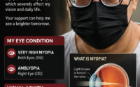 very high myopia, severe myopia, high myopia symptoms, high myopia treatment, myopia causes, myopia remedies, pathological myopia, myopia complications, myopia eye surgery, vision loss awareness